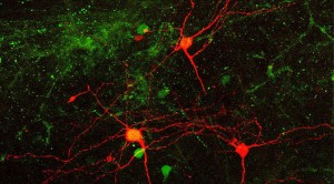 mouse cortical neurons